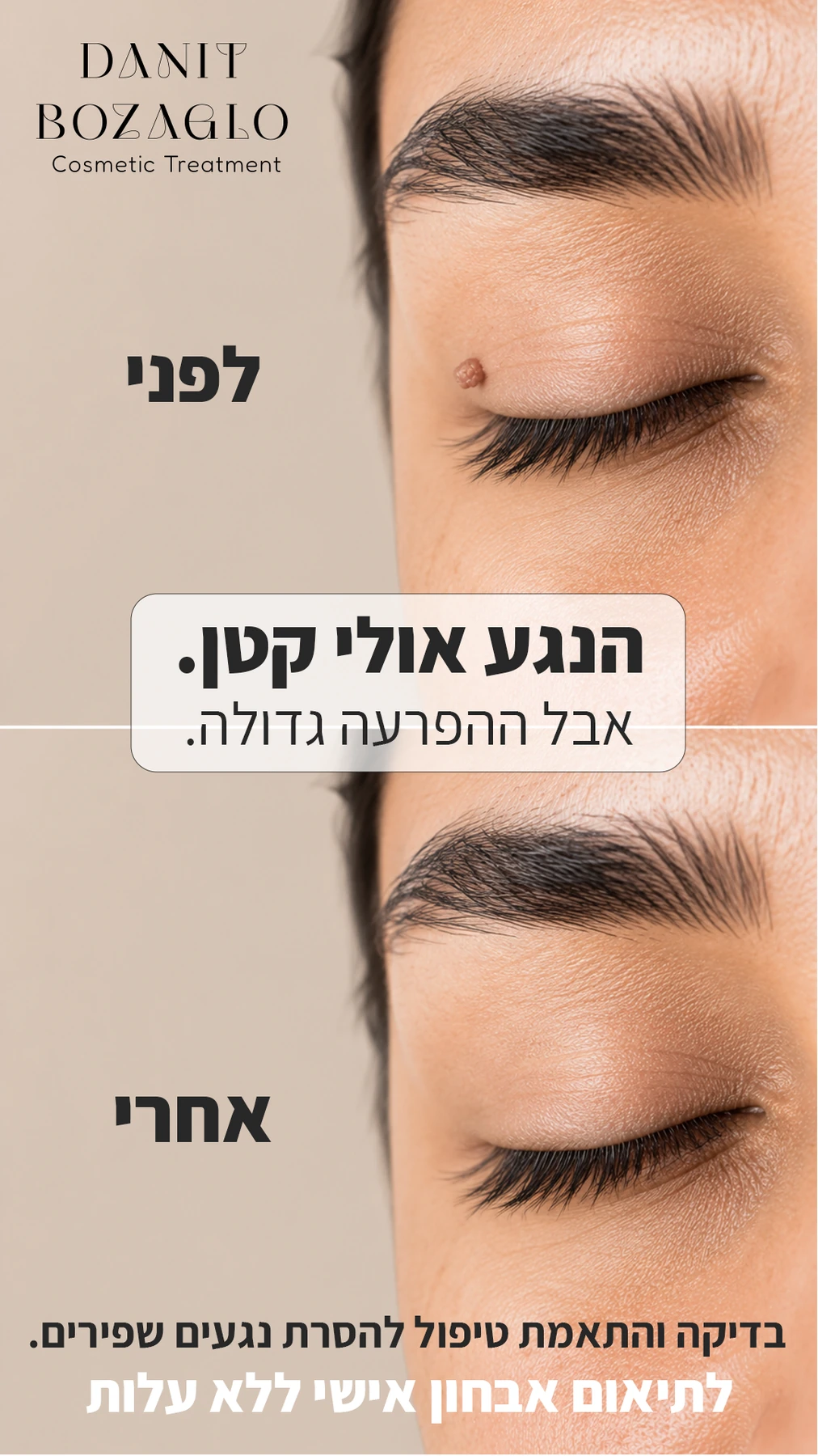 קריאייטיב לפני ואחרי לדנית בוזגלו